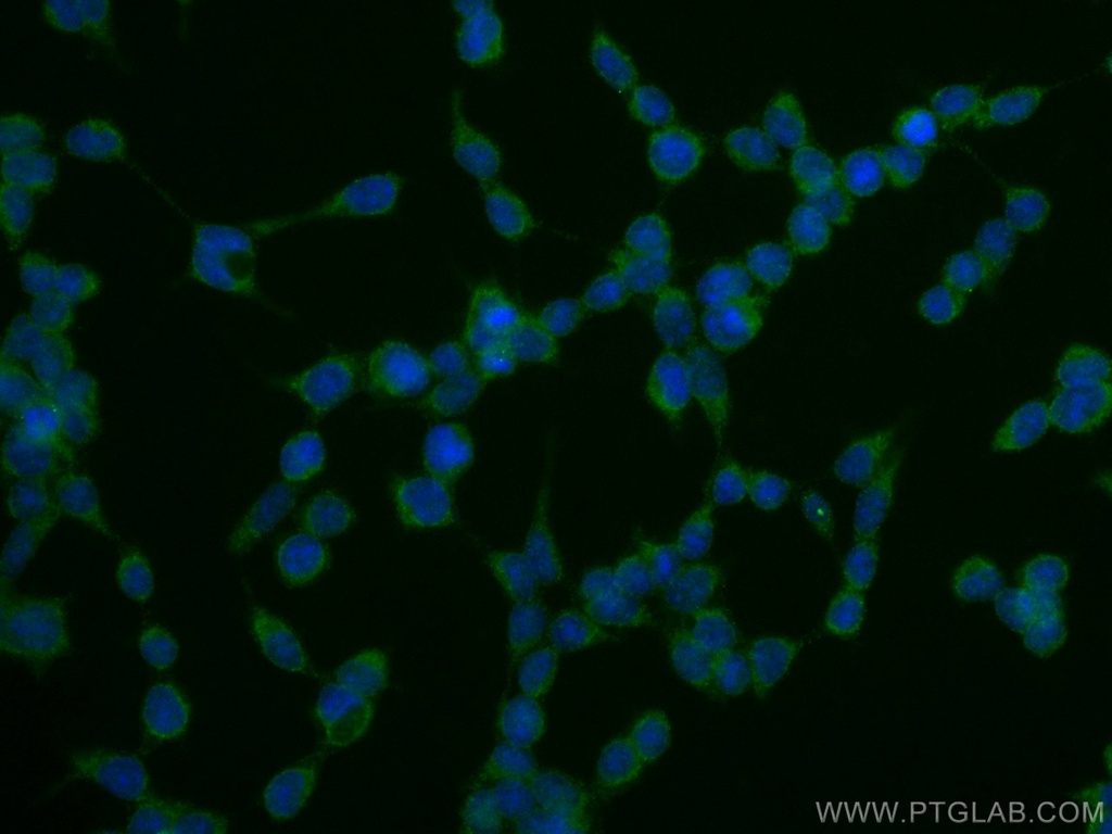 SOD1 Monoclonal antibody