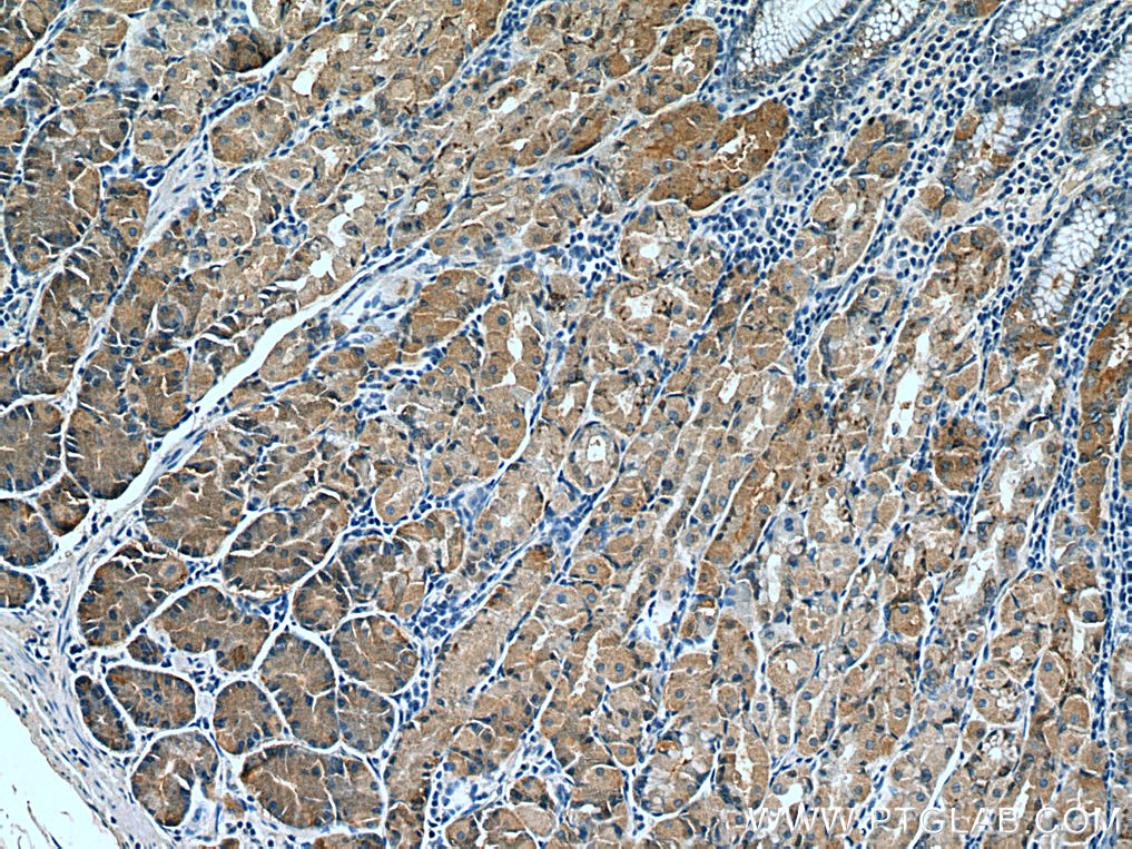 AHCYL2 Monoclonal antibody