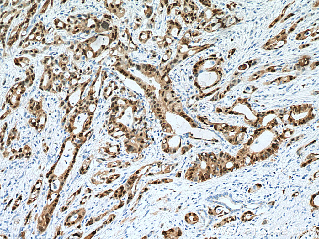 S100P Monoclonal antibody