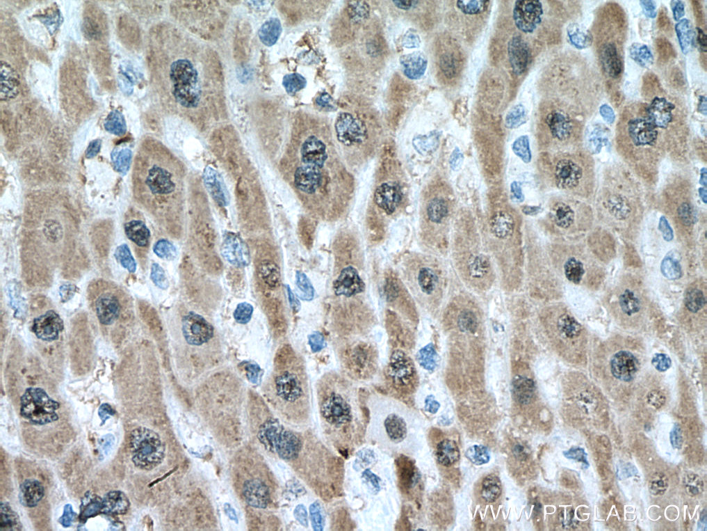UNG Monoclonal antibody