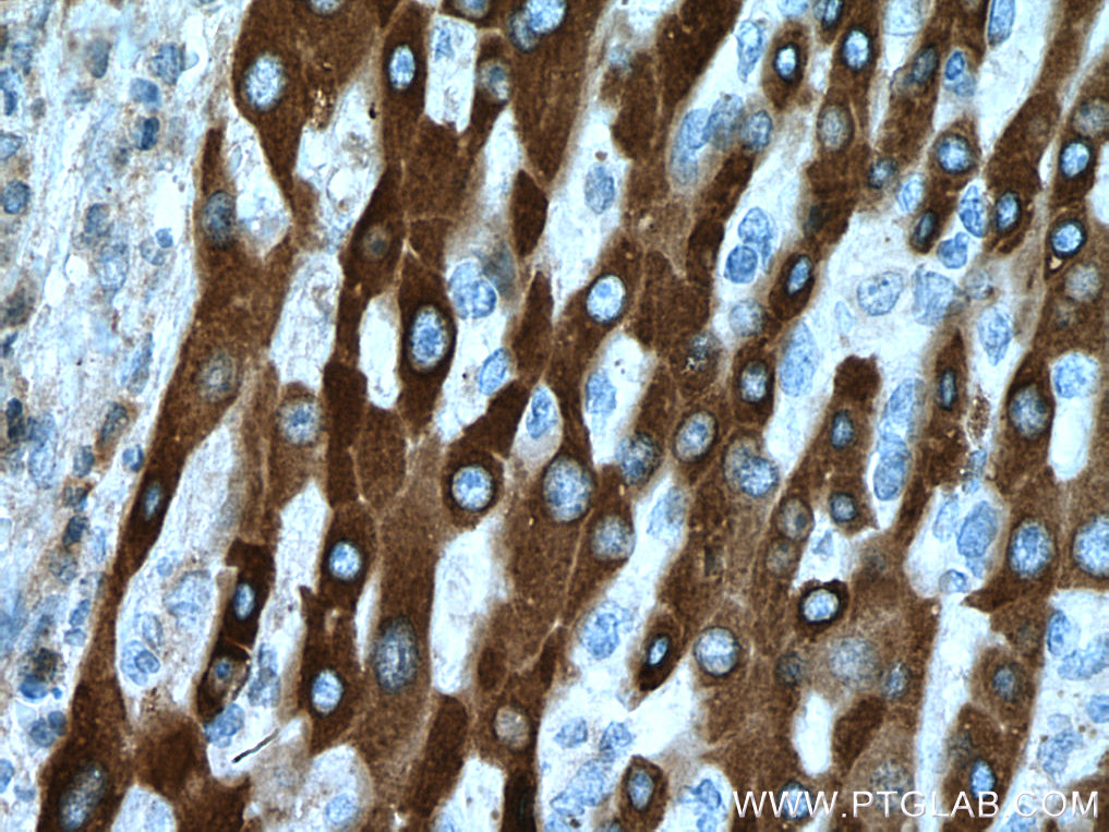 HSD17B6 Monoclonal antibody