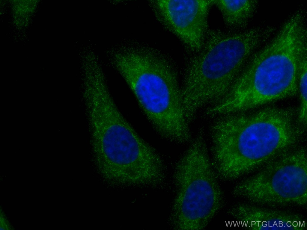 GNB3 Monoclonal antibody