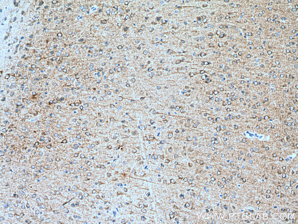 CDK5R1 Monoclonal antibody