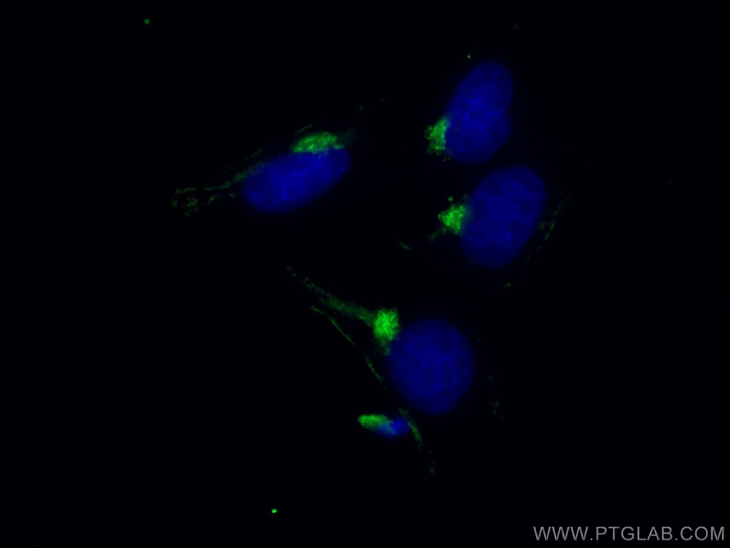 TMF1 Monoclonal antibody