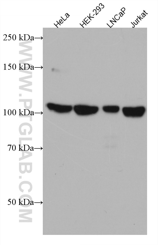 RBM15B Monoclonal antibody