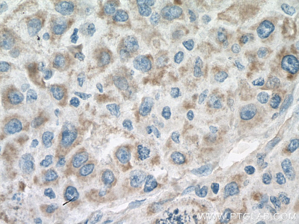ACO2 Monoclonal antibody