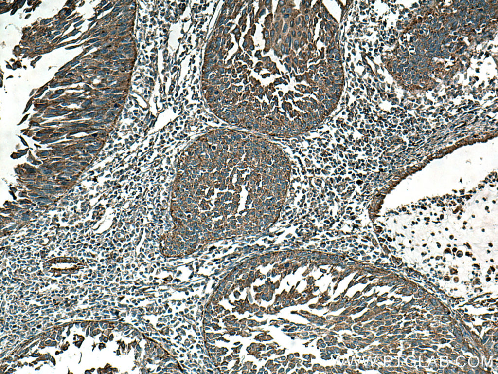 BSEP Monoclonal antibody