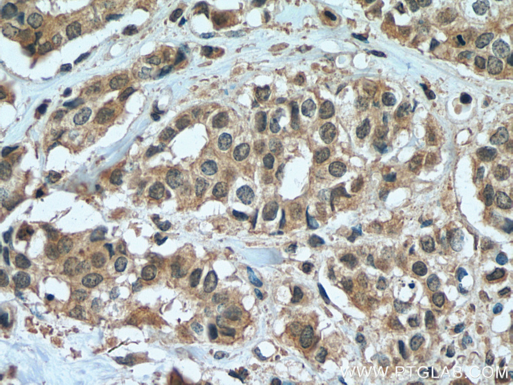 ZEB2 Monoclonal antibody