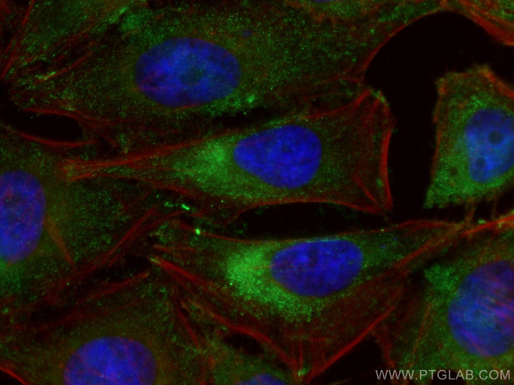 HPRT1 Monoclonal antibody