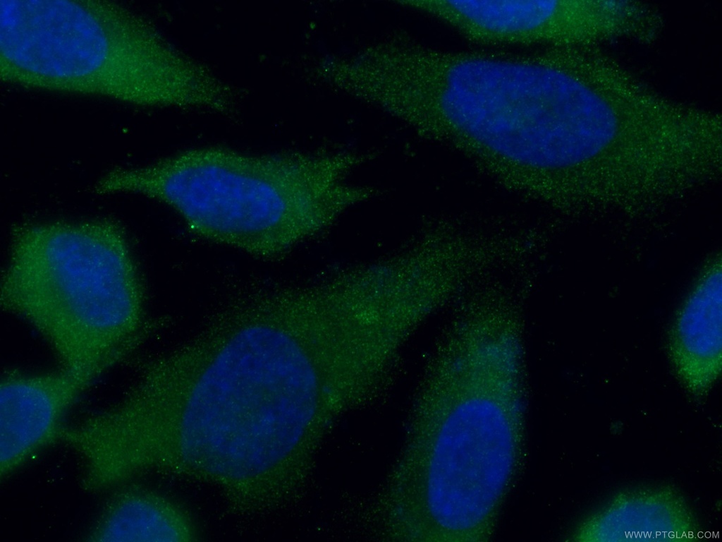 CMPK1 Monoclonal antibody