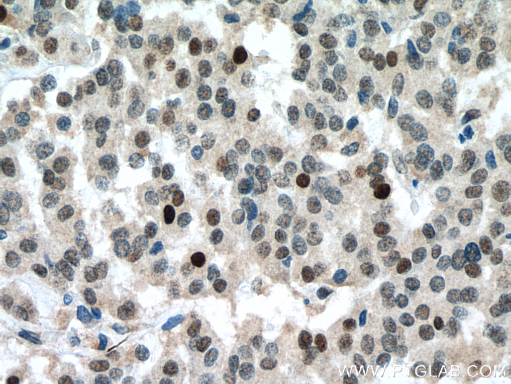 RB1 Monoclonal antibody