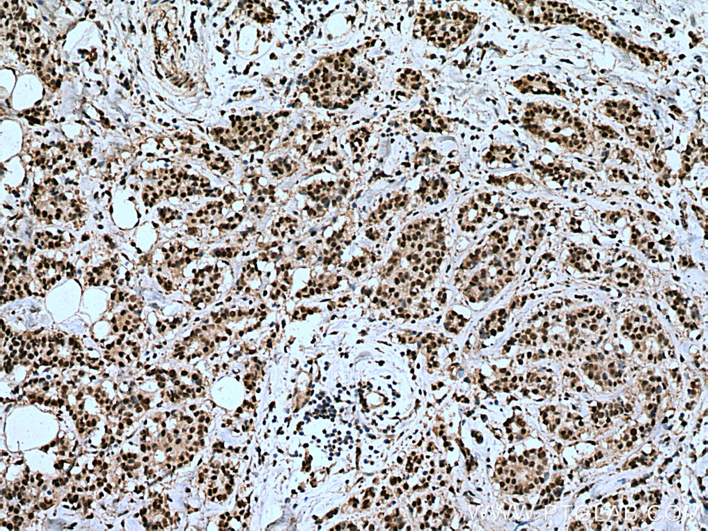 IPO7 Monoclonal antibody