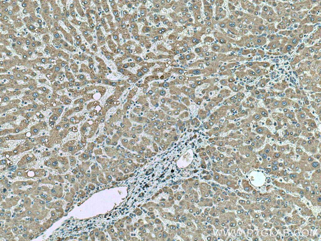SLC2A9 Monoclonal antibody