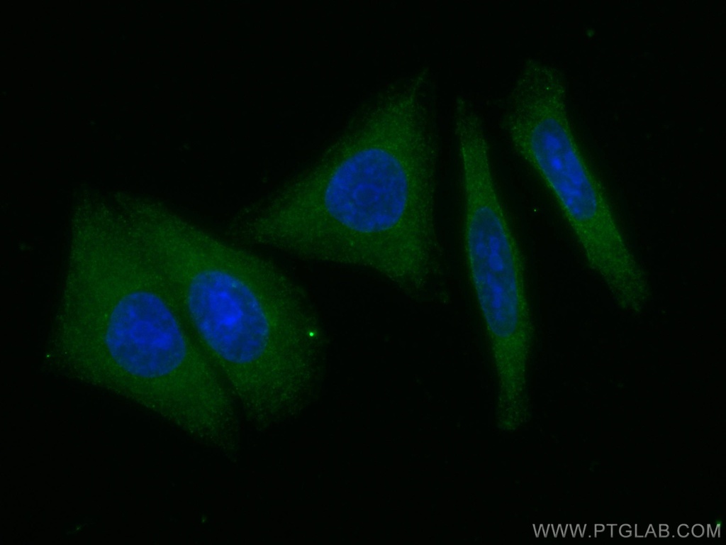 GPT/ALT1 Monoclonal antibody
