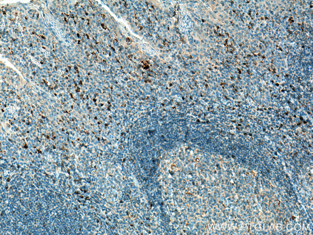 KLRB1/CD161 Monoclonal antibody