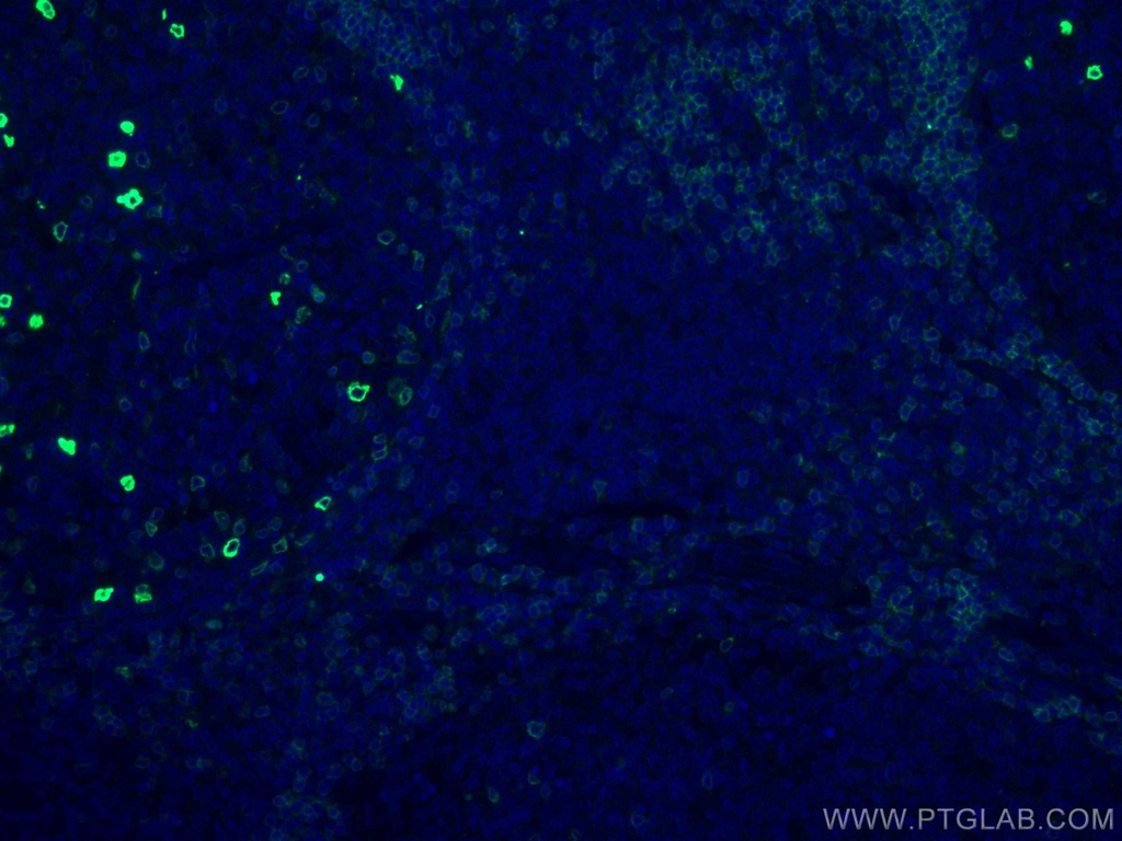 IGHD Monoclonal antibody