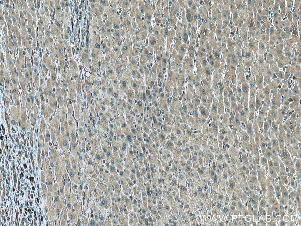 CCT8 Monoclonal antibody