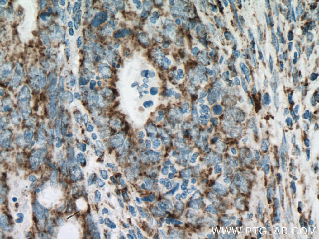 UQCRC2 Monoclonal antibody