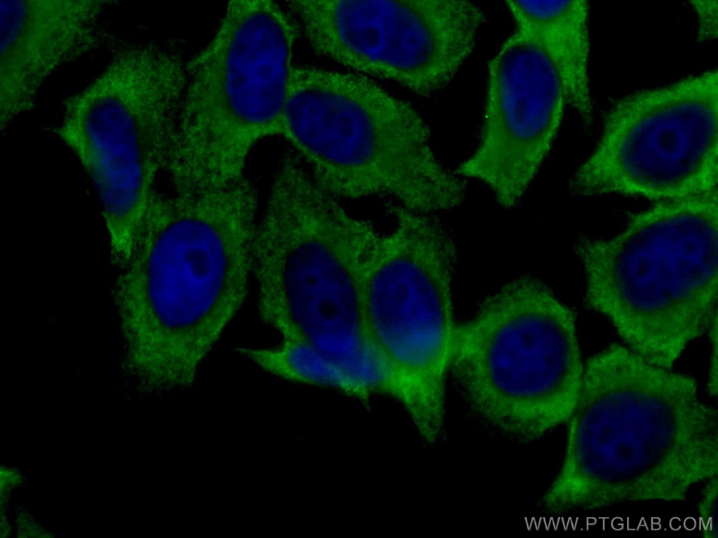 EEF2 Monoclonal antibody