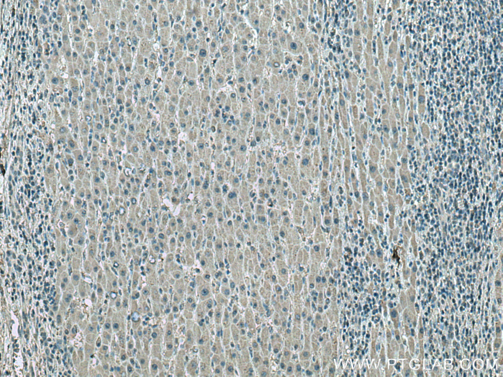 ATP1B3 Monoclonal antibody