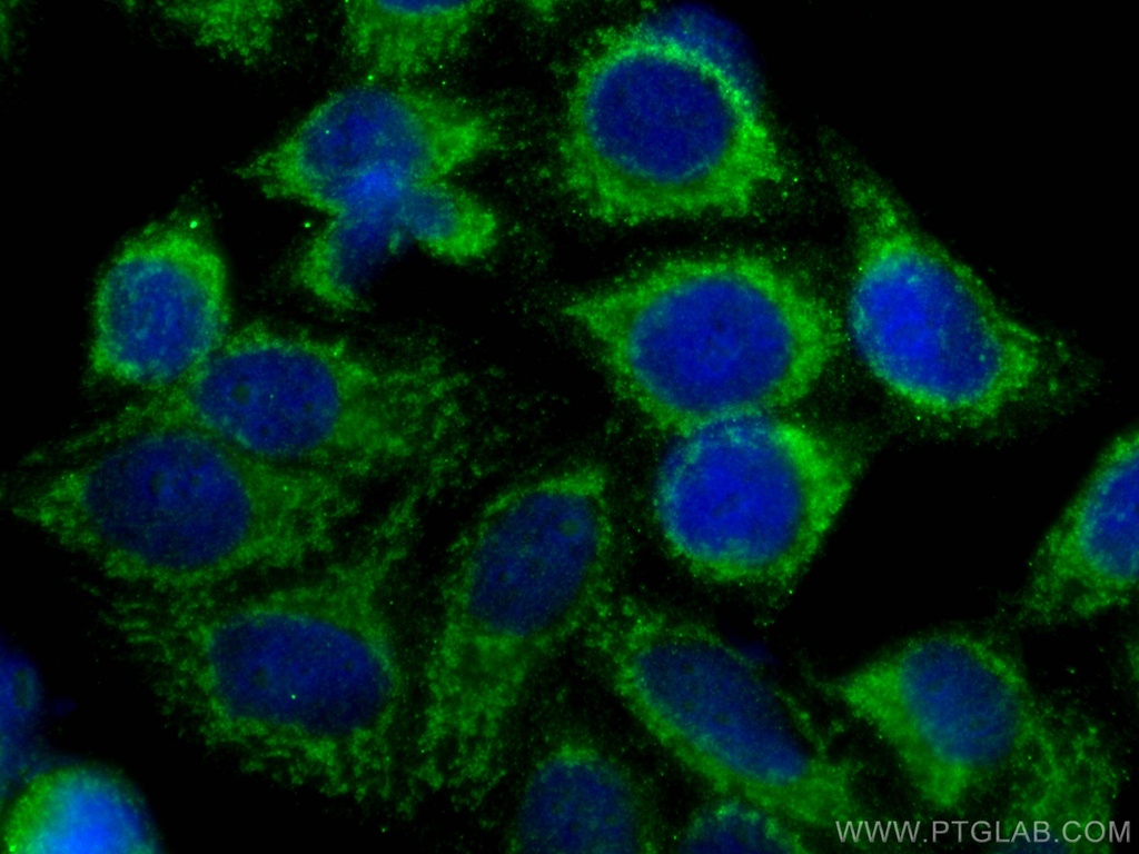 RIG-1/DDX58 Monoclonal antibody