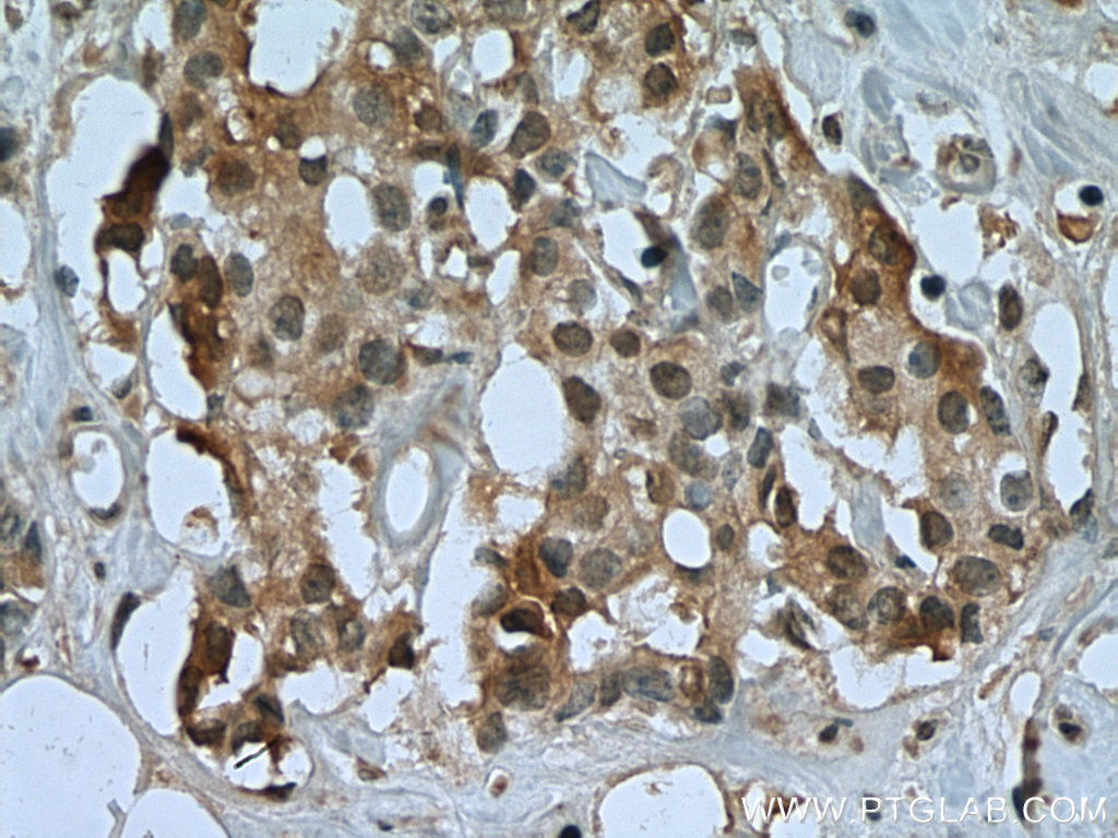 USP15 Monoclonal antibody