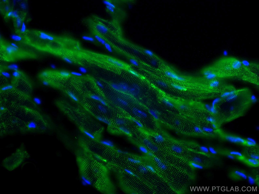MTMR14 Monoclonal antibody