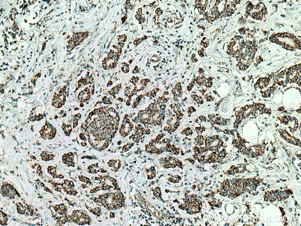 GRP75 Monoclonal antibody