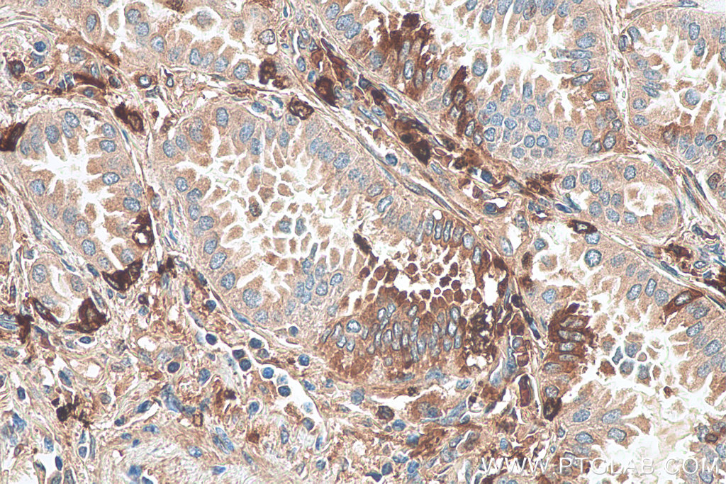 PICALM Monoclonal antibody