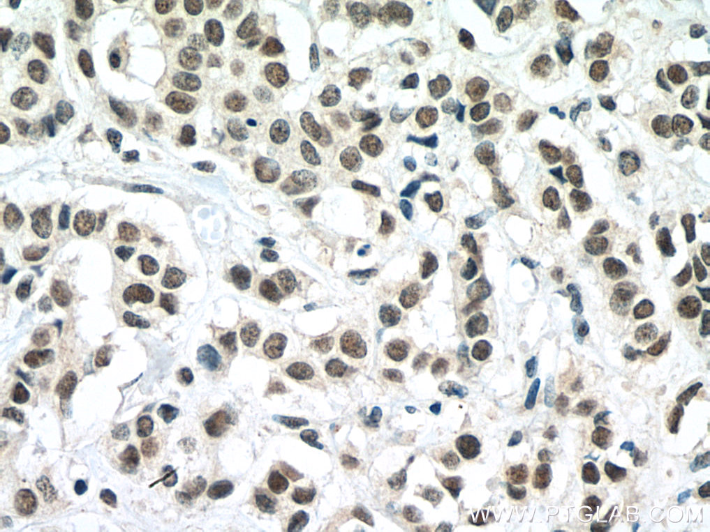 TAF6L Monoclonal antibody