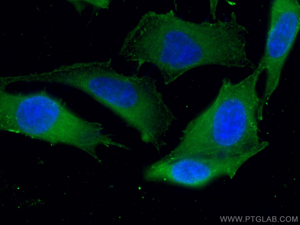 ATM Monoclonal antibody