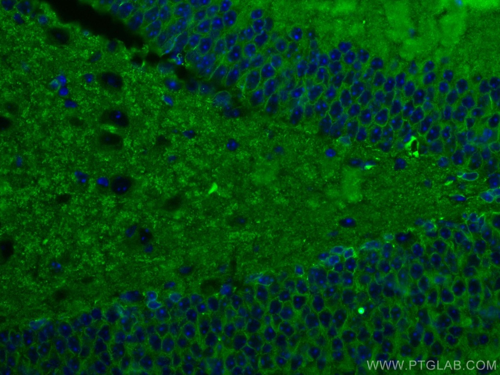 Drebrin Monoclonal antibody