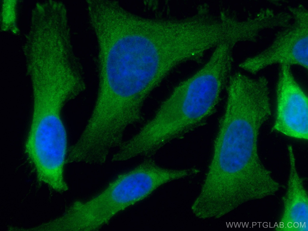 PHGDH Monoclonal antibody