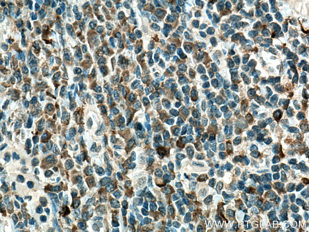 NCF2 Monoclonal antibody
