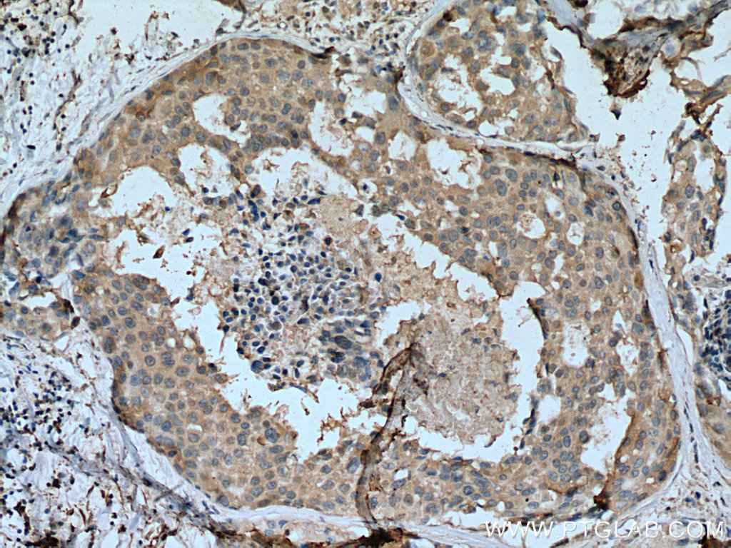 SCLY Monoclonal antibody