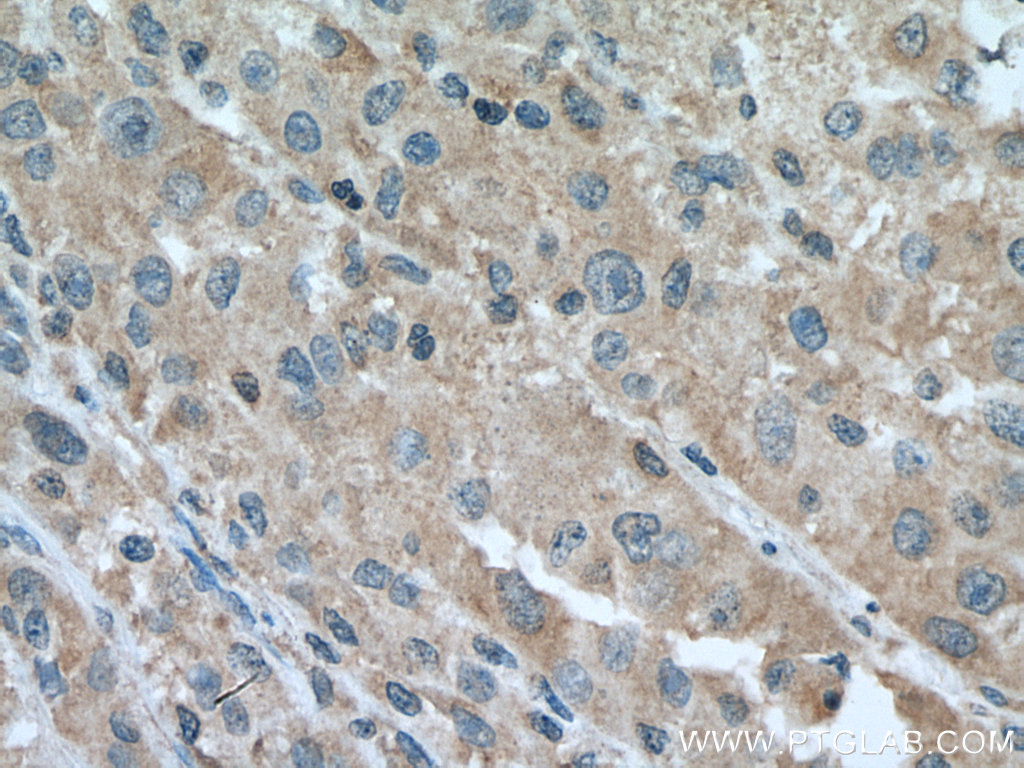 FAAH Monoclonal antibody