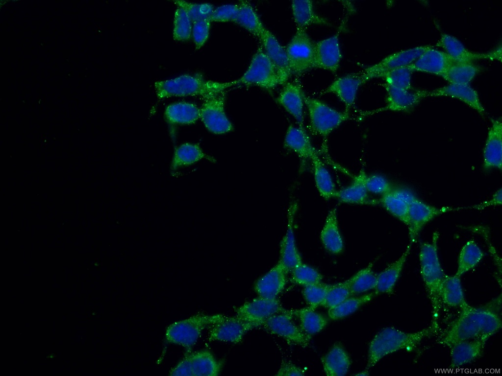 VPS53 Monoclonal antibody