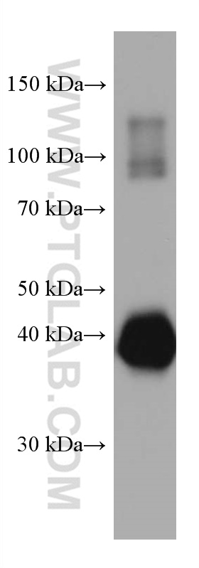 Ovalbumin Monoclonal antibody