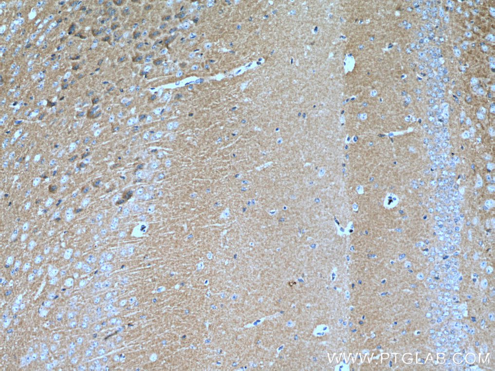 NCS1 Monoclonal antibody