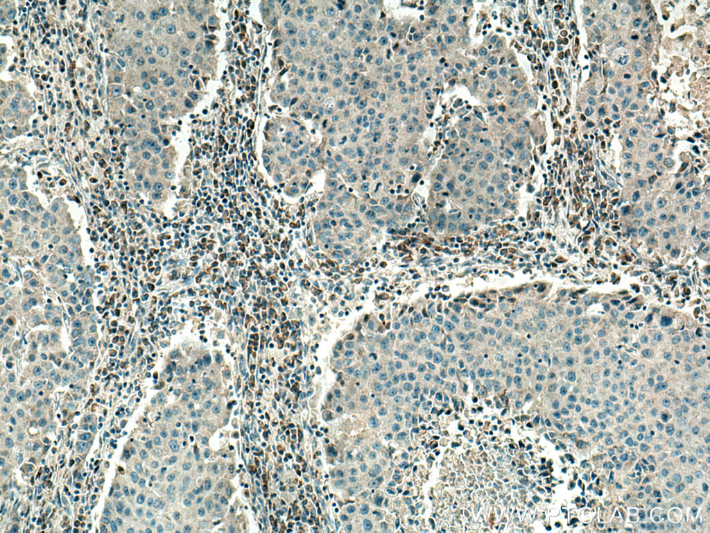 PSAT1 Monoclonal antibody