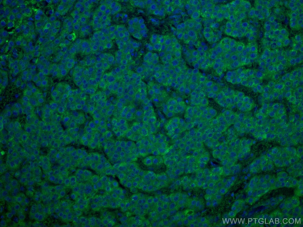 WASF3 Monoclonal antibody