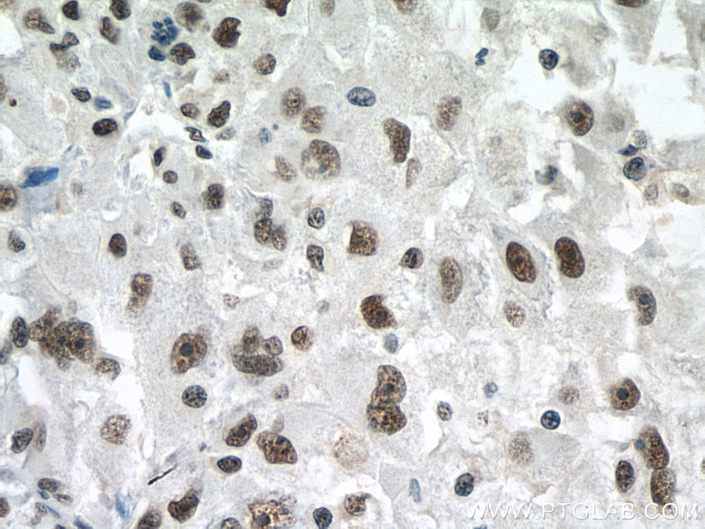 PSME3 Monoclonal antibody