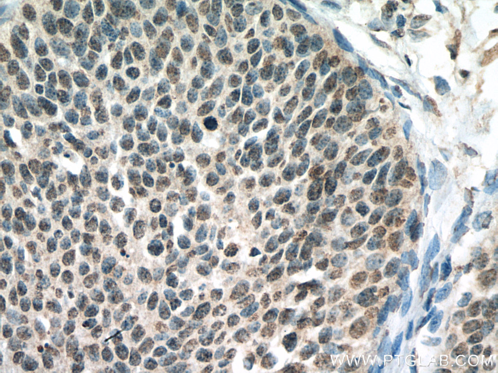 PPID Monoclonal antibody
