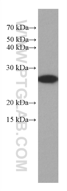 GSTM3 Monoclonal antibody