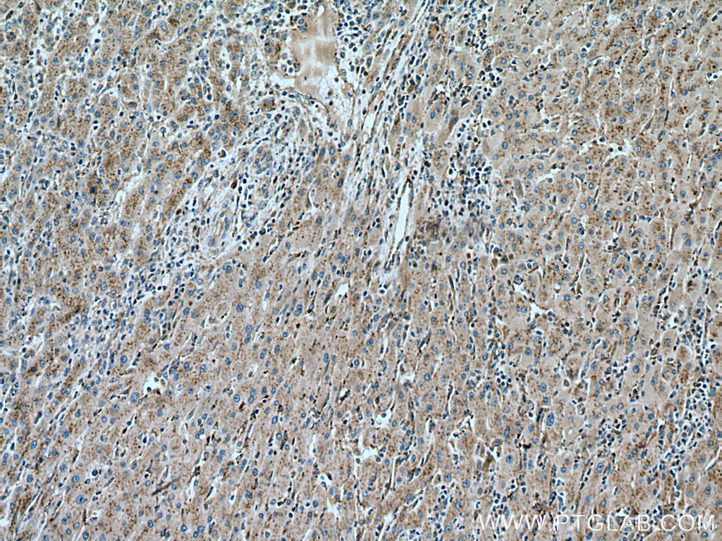SLC25A17 Monoclonal antibody