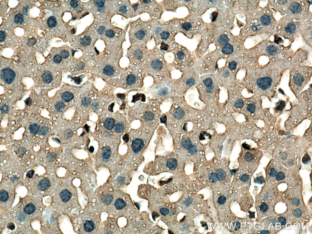GSTT1 Monoclonal antibody