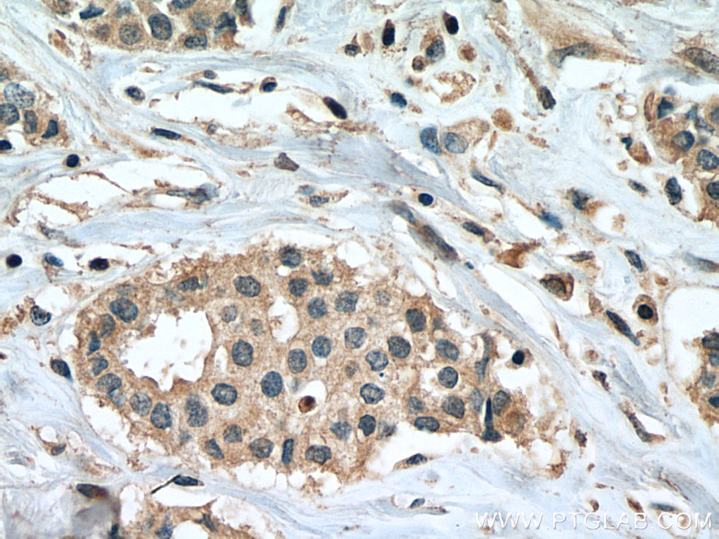PPM1B Monoclonal antibody