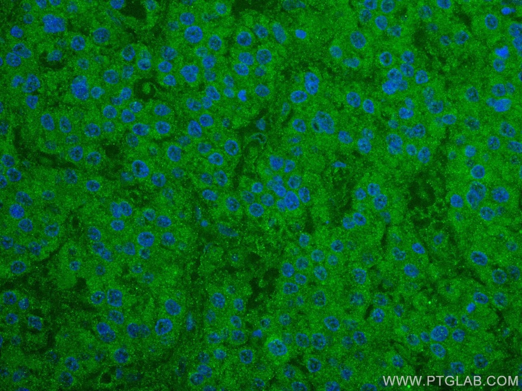 NCAPH Monoclonal antibody