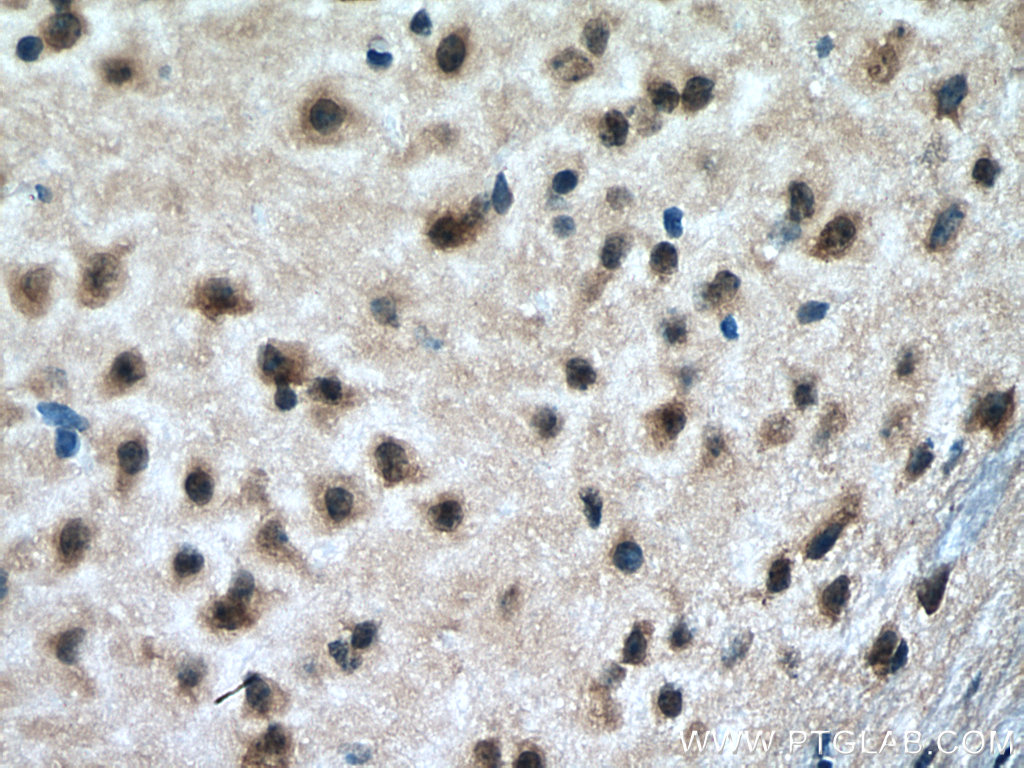 RAB18 Monoclonal antibody
