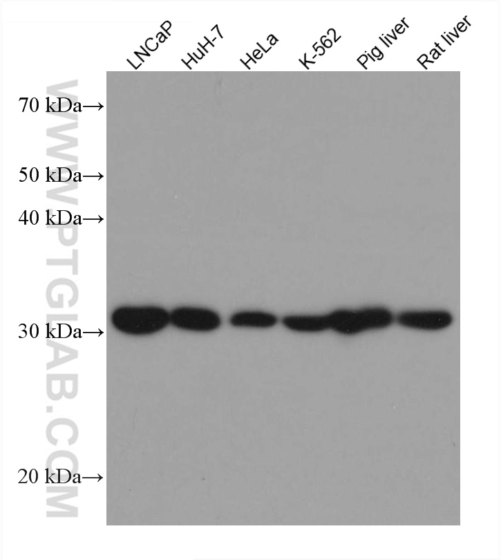 ETFA Monoclonal antibody